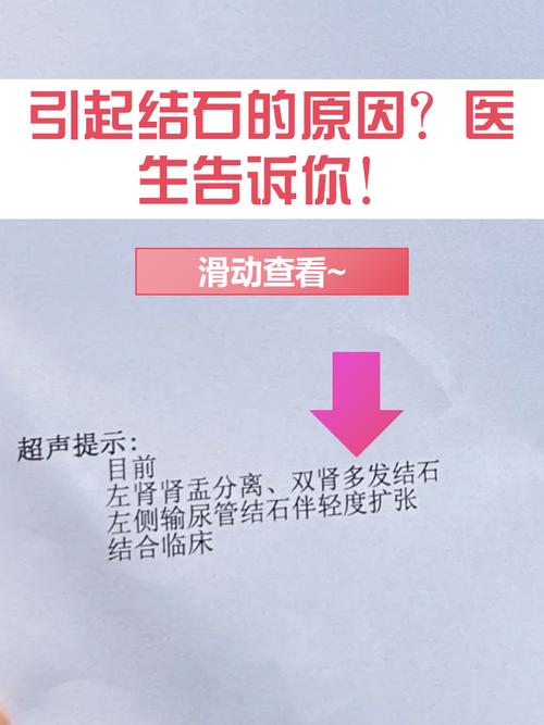 什么是尿酸性肾结石_尿酸性结石的症状表现