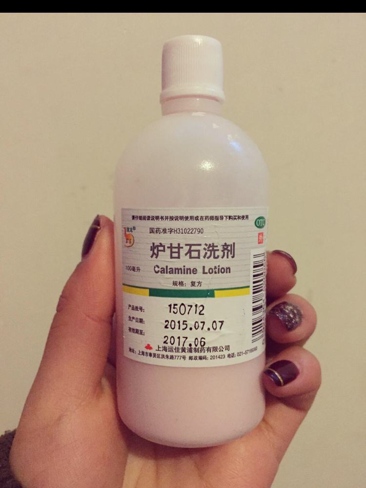 儿童去痱子止痒最有效的方法-儿童去痱子止痒最有效的方法有哪些